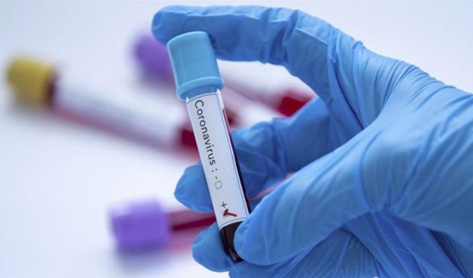 Лабораторно підтверджено 14 нових випадків COVID-19 в області 