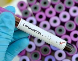 Лабораторно підтверджено 548 нових випадків COVID-19 в області за минулу добу. Від ускладнень померло ще 18 хворих 